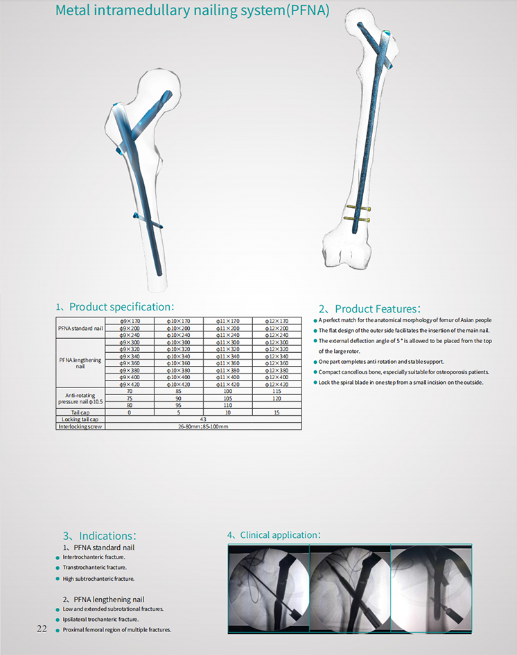 Competitive Price CE Marked Metal PFNA Femoral and Reconstructional Intramedullary Nail for Trauma Surgery