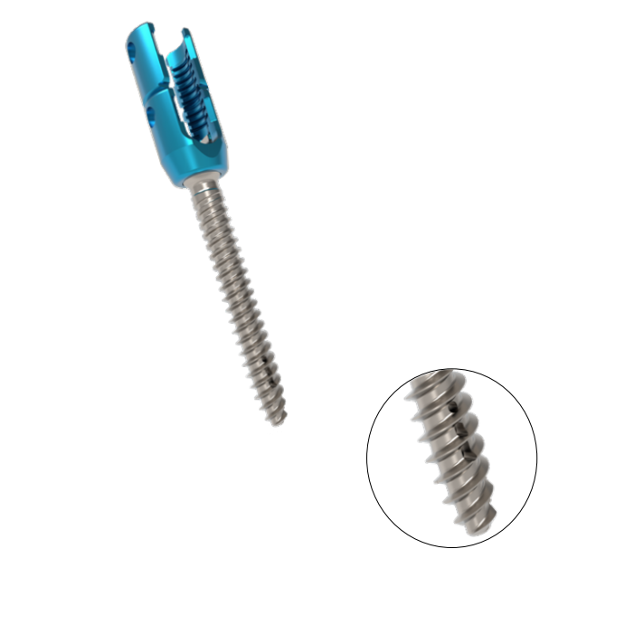 High Quality Orthopedic Surgery 6.0 COX Monoaxial Pedicle Screw and Rod System High Quality Orthopedic Surgery Implant