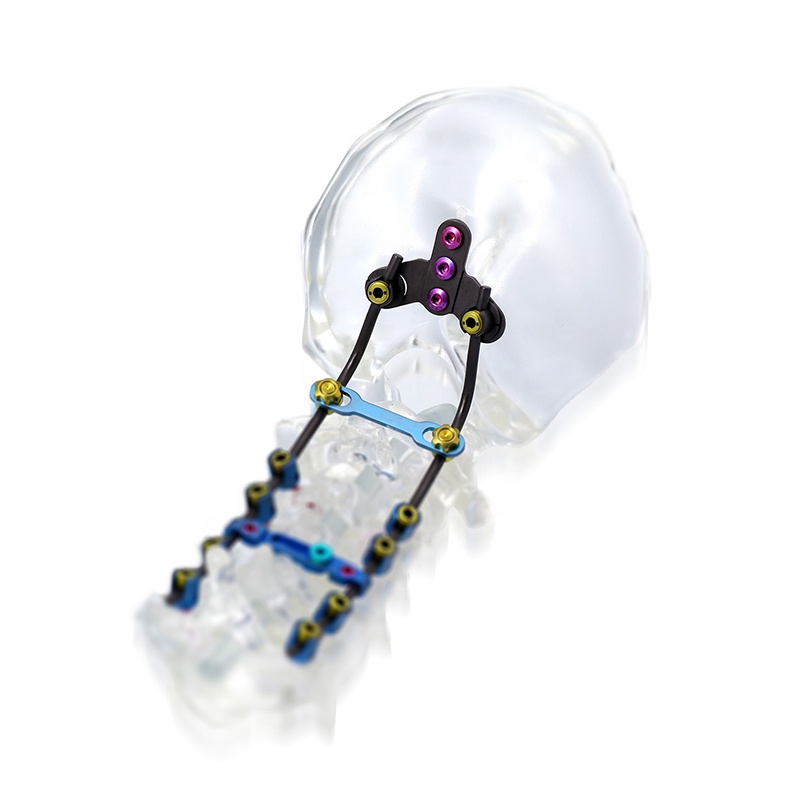Occipitocervical Thoracic Spinal Screw-Rod System Posterior Interventional Titanium Implants & Materials