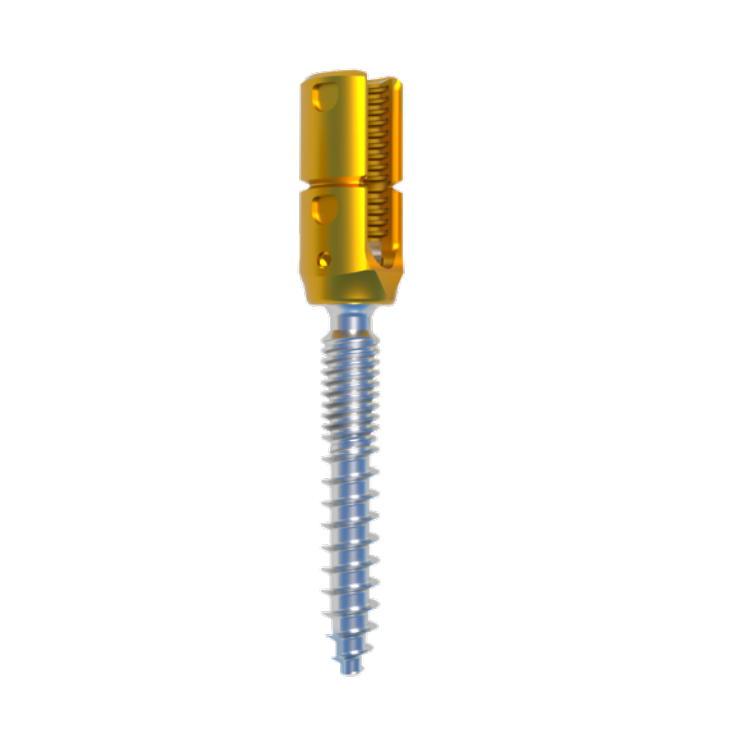 Orthopedic Implants and Instruments Set Polyaxial Spine Titanium Pedicle Screws Upgraded Usmart 5.5 Spinal Screw-Rod System