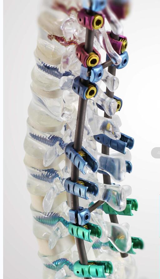 High Quality and Competitive Price Bone Cement Screw with Various of Types