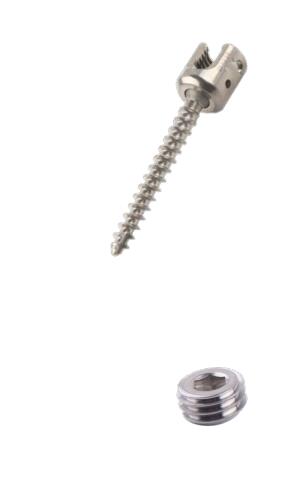 China Manufacture Competitive Price CCS Pediatric Spinal Screw-Rod System Titanium CE Certified 5-Year Warranty