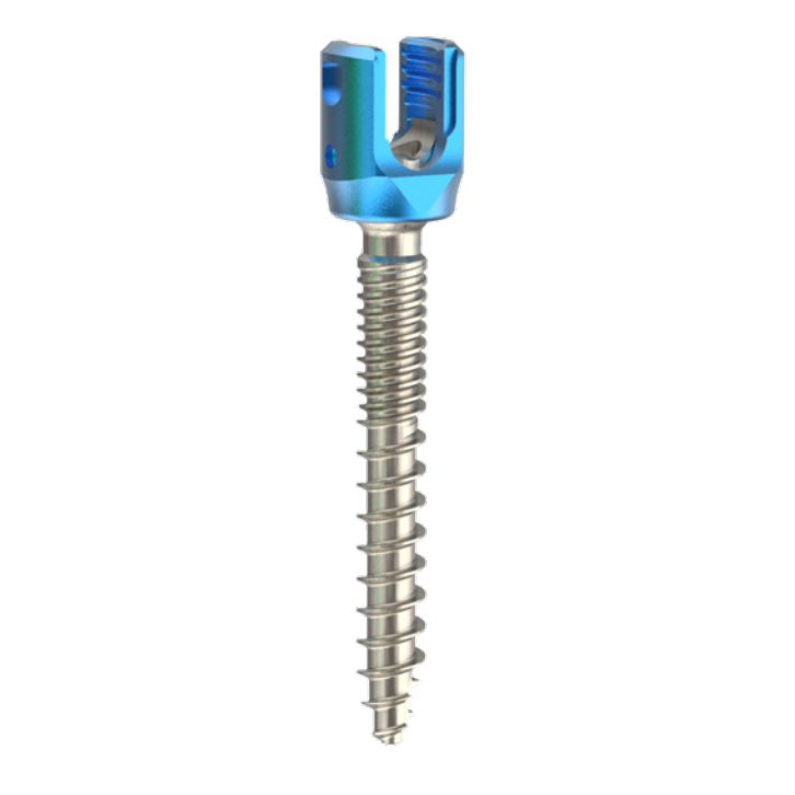Orthopedic Implants and Instruments Set Polyaxial Spine Titanium Pedicle Screws Upgraded Usmart 5.5 Spinal Screw-Rod System