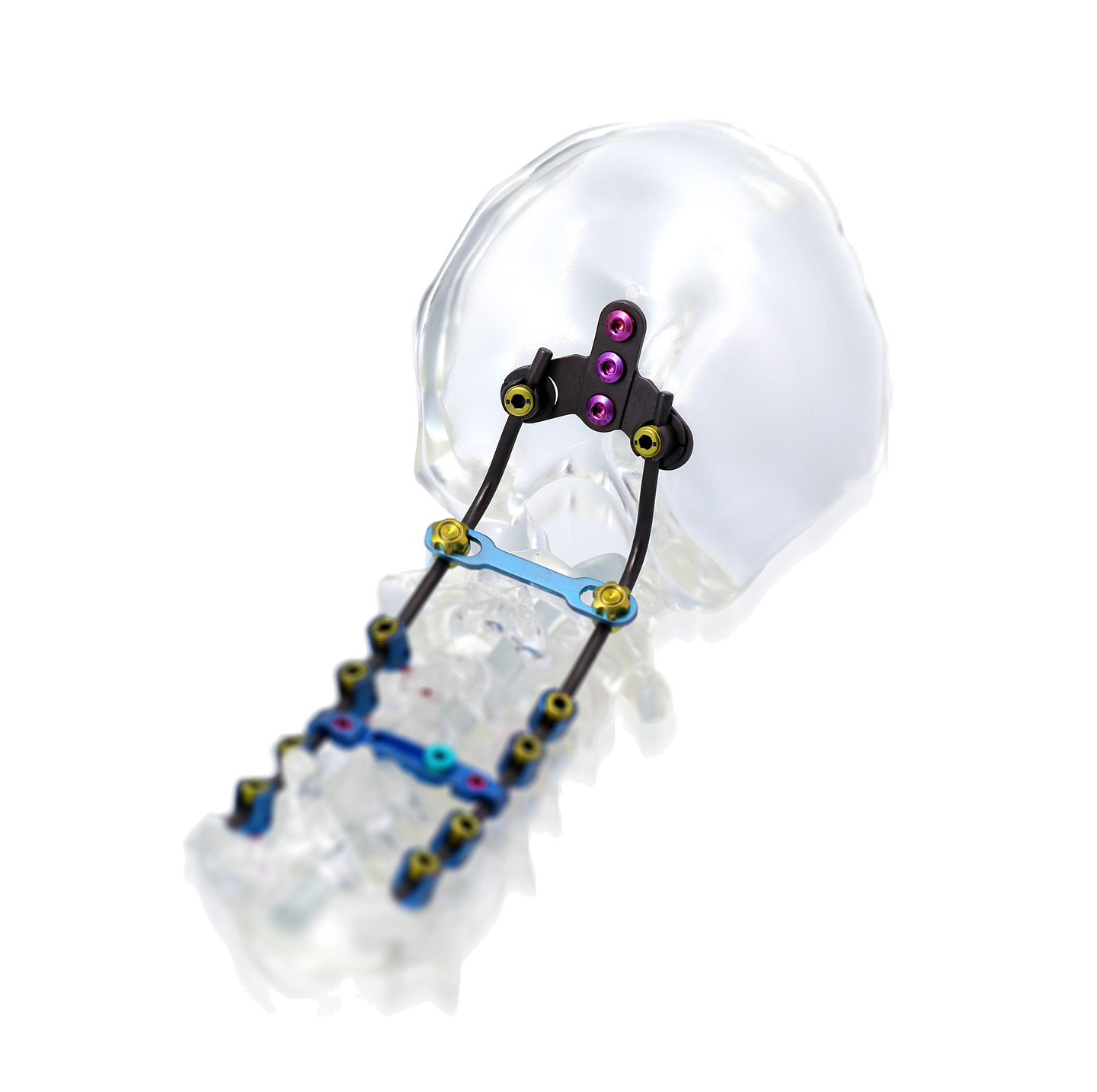 Beijing Fule Occipitocervical Thoracic Posterior Spinal Screw-Rod System Model CFS Made of Durable Titanium and Titanium Alloy