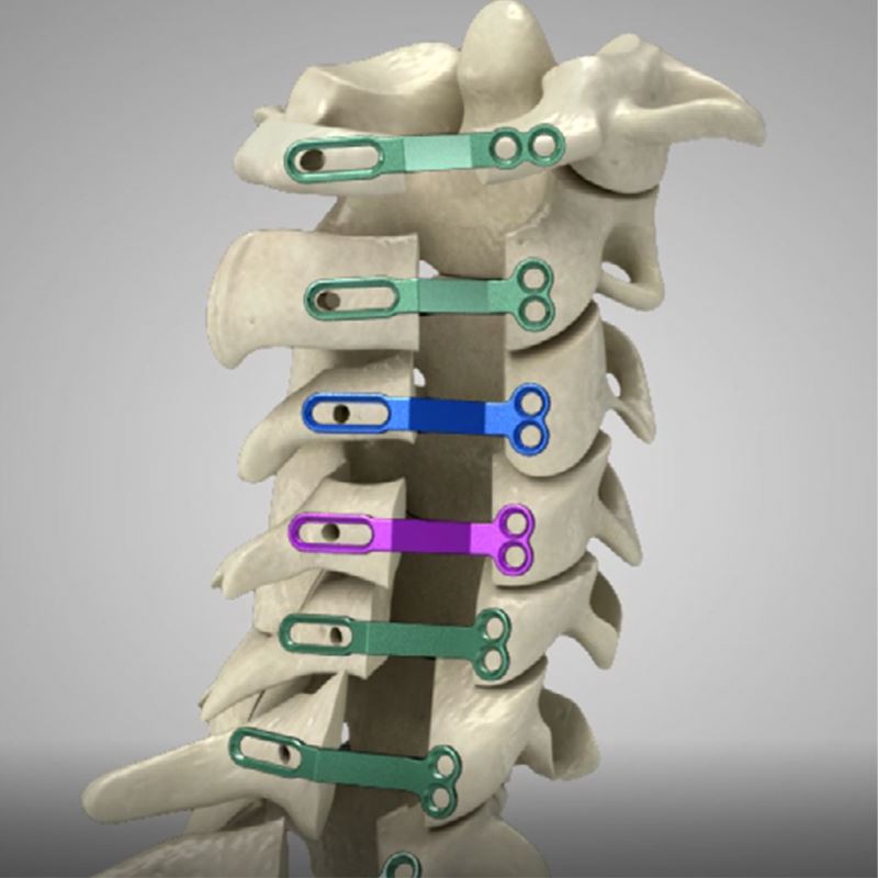 High Quality Posterior Cervical Laminoplasty Surgical System for Enhanced Spinal Decompression