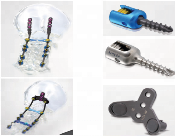 Beijing Fule Occipitocervical Thoracic Posterior Spinal Screw-Rod System Model CFS Made of Durable Titanium and Titanium Alloy