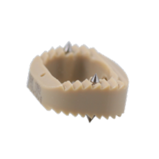 Orthopedic Implant Cervical Interbody Fusion Cage Arc-shaped Wedge-shaped PEEK Titanium Alloy OEM Fule Brand CE Certified 5-Year