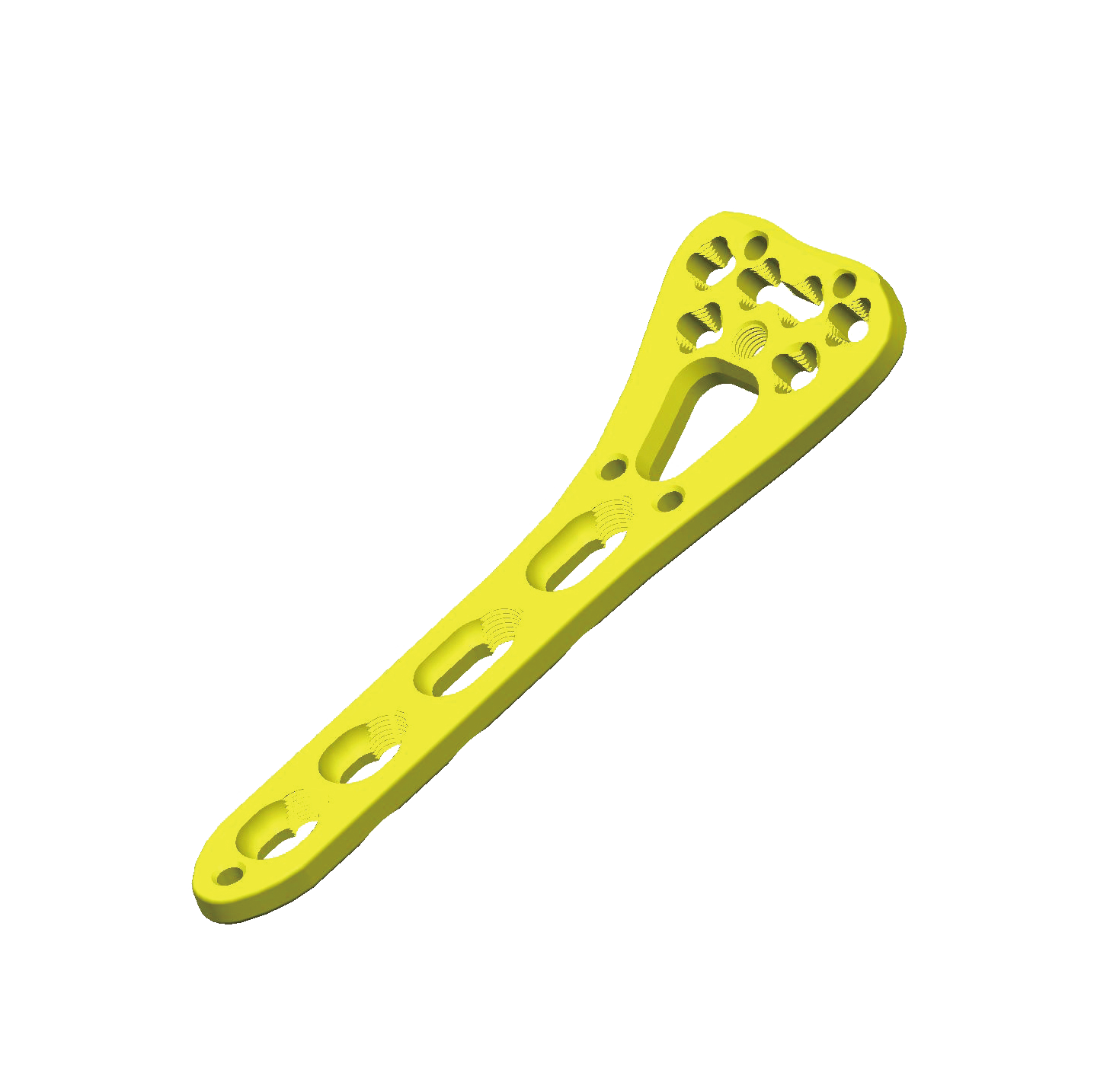 China Manufacture Fule Titanium Orthopedic Bone Plate Proximal Distal T-Oblique Olencranon for Bone Fracture Fixation