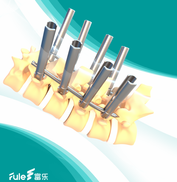 High Quality and Competitive Price Bone Cement Screw with Various of Types