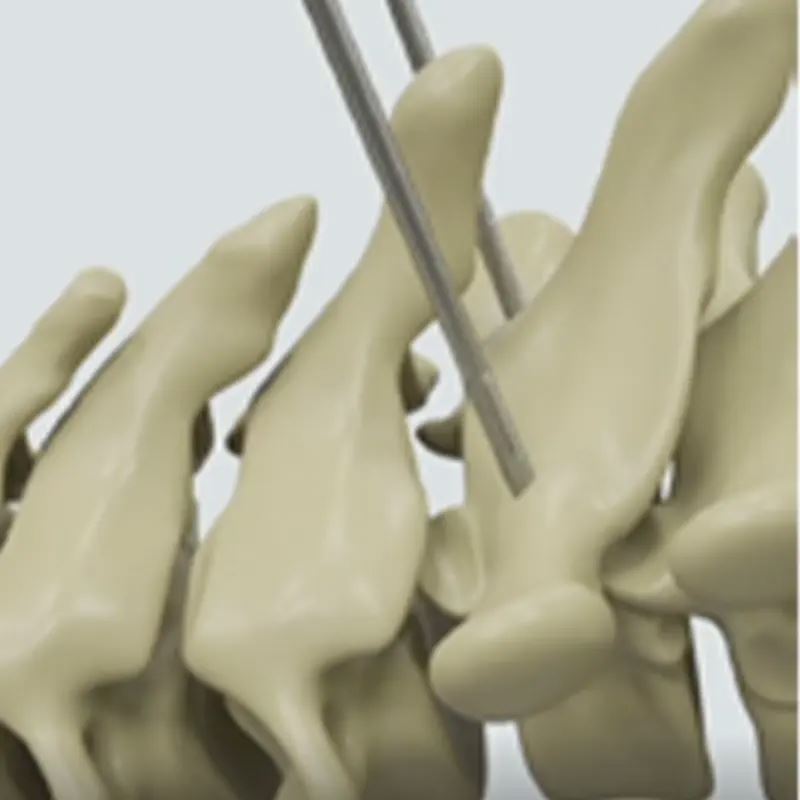 High Quality Hot Selling Cheap Durable Titanium 5.0mmCSS System for Spine Surgery Implantable Artificial Organs Fule Brand 5+