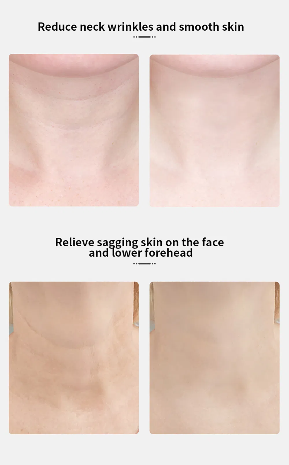 Photon Device Skin Care Electric Anti-Wrinkle Facial Neck Massage Machine Face Lifting Neck Beauty LED EMS