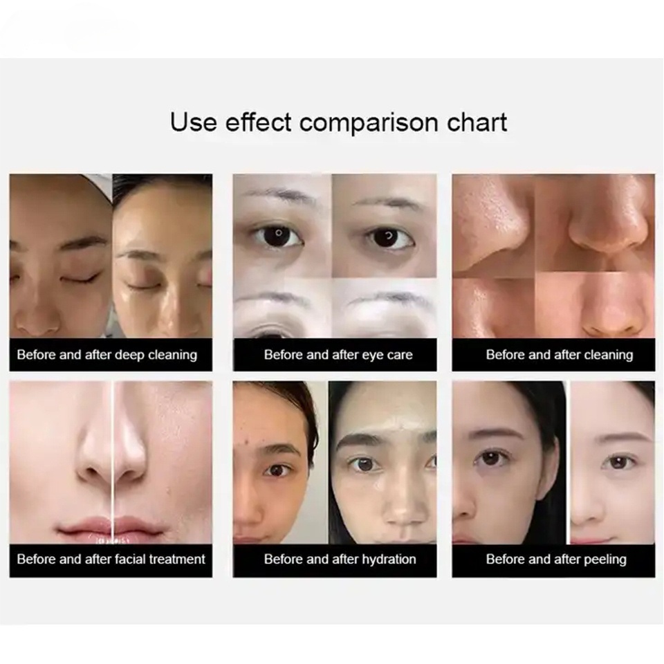 8 In 1 Microdermabrasion Oxygen Facial Skin Care Deep Cleansing With Skin Analyzer Facial Machine With Skin Detection System