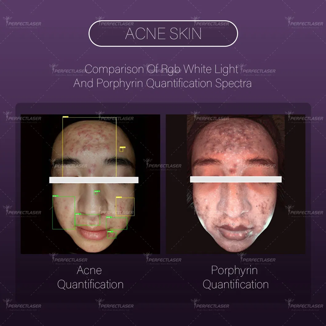 Best Ai Smart 15.6 Inch Screen Skin Analysis Machine