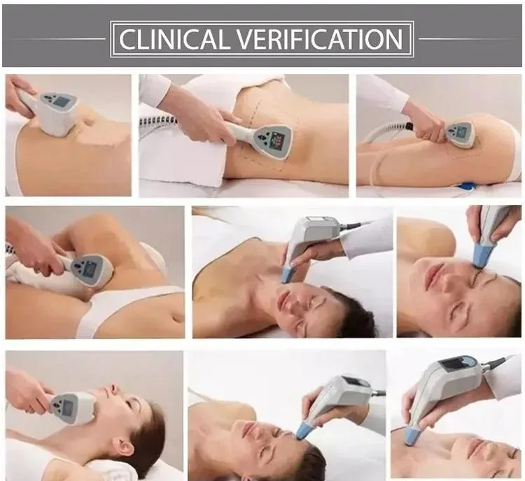Portable RF Slimming Machine Ultrasound RF Cellulite Removal Wrinkle Removal Face Lift 2 Handles Ultra 360 Facial Machine
