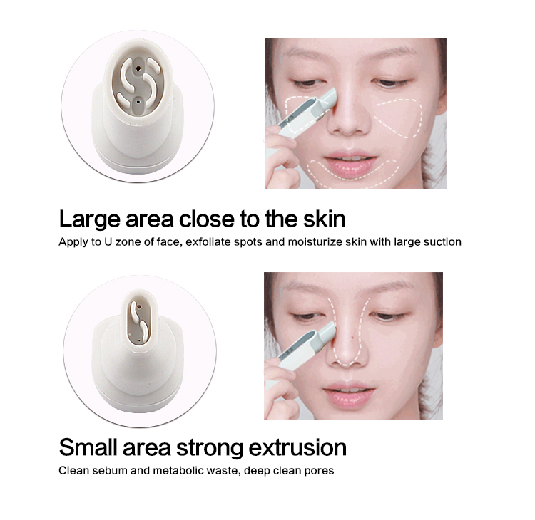 Hydrodermabrasion Face Cleaning Machine View 3