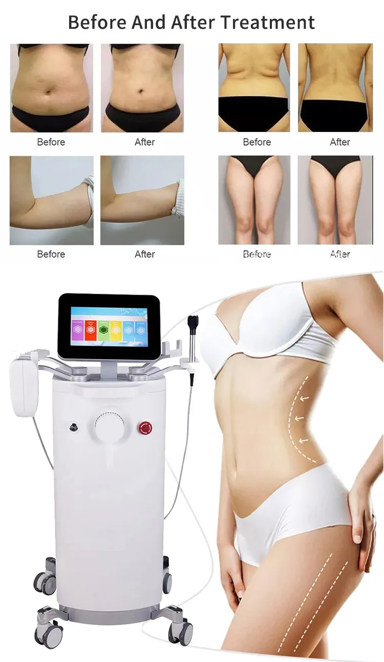 Popular Cellulite Fat Weight Loss for Belly Reduction Shaping Slimming Exercise Machine SPA slimming Beauty Machine Fat Burning Device