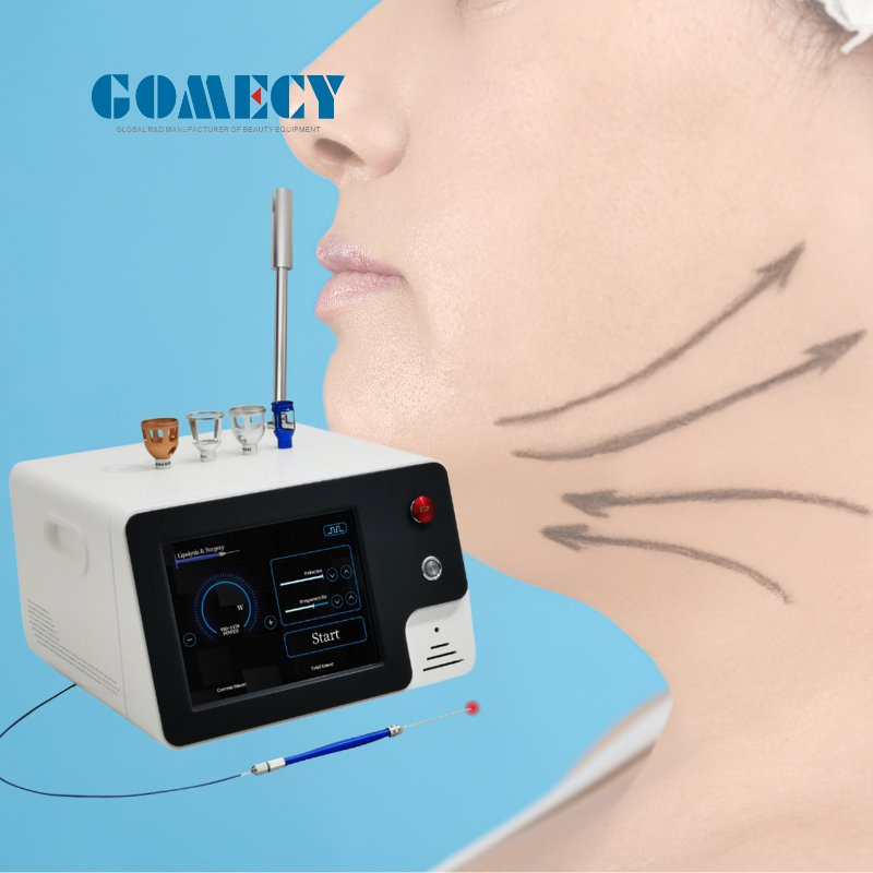 980 Nm 1470nm Portable Endolaser Endolaser Diode Para Lifting Facial Face Lifting Fat Lipolysis Machine 980nm