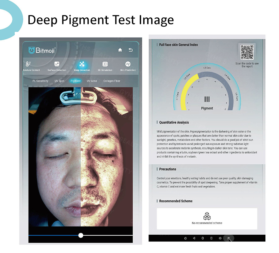 Ai Skin Scanner Machine for Skin Diagnosis Deep Facial Analysis Equipment