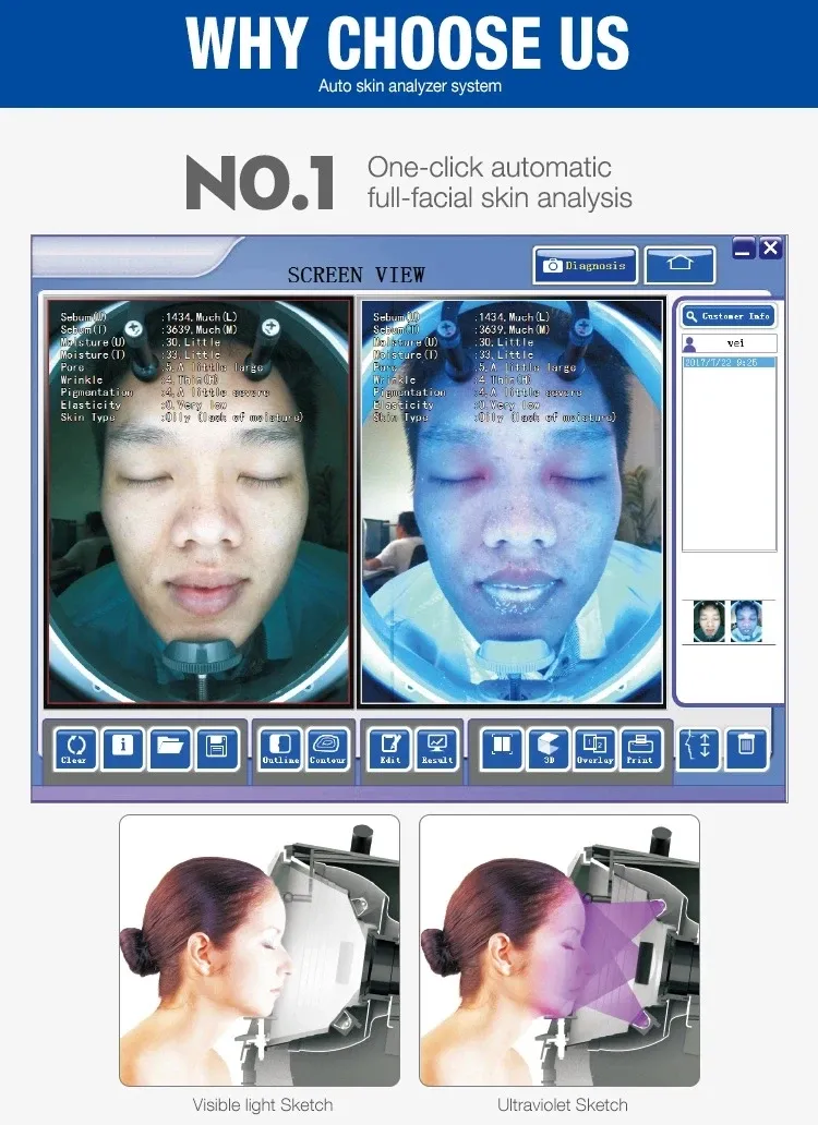 Skin Analyzer Feature Image 1