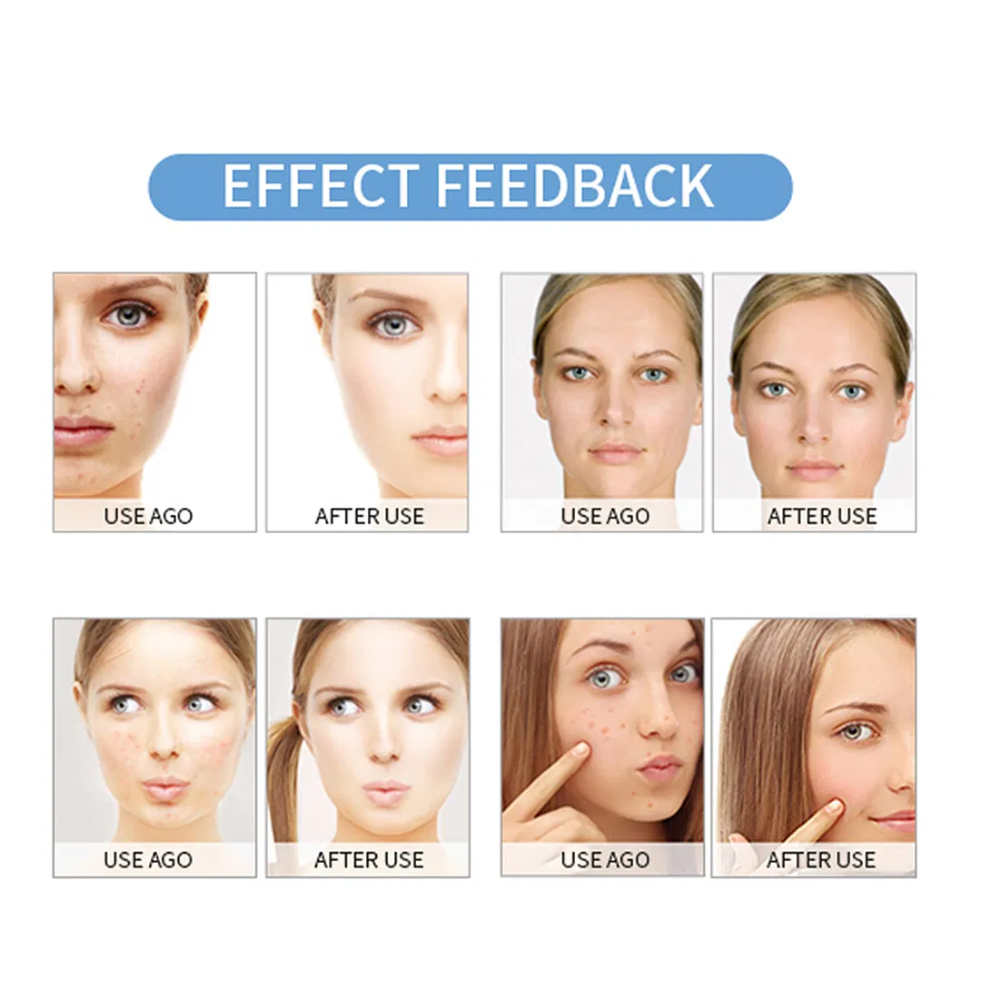 Portable Aqua Peel Microdermabrasion Hydra Machine H2O2 Hidra Hydrodermabrasion Facial Machine