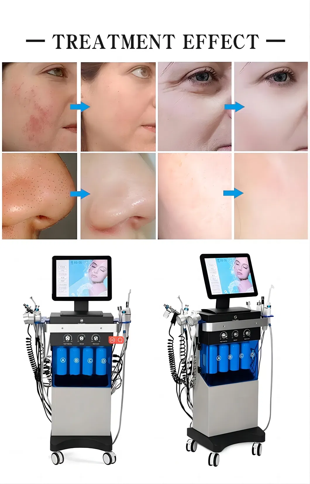SPA Hydra Care Microdermabrasion Parameter 4