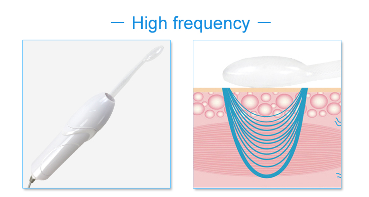 High Frequency Device