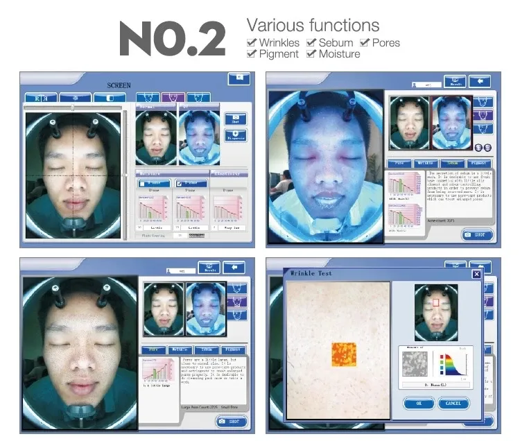 Skin Analyzer Feature Image 2
