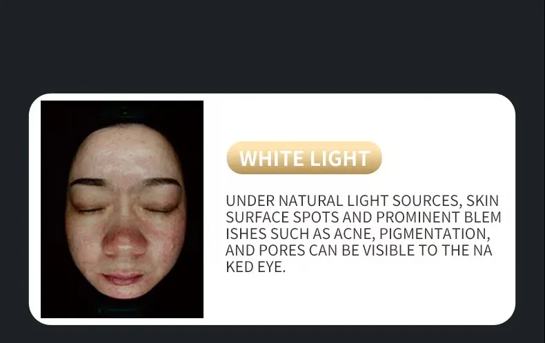 X5 Ultra Clear Skin Analyzer Ai Face Scanner 3D Facial Analysis Machine