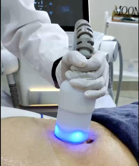 Cryo Thermal Shock Hot Cold Body Slimming Machine Facial Y Corporal Criolipolisis Plana with EMS