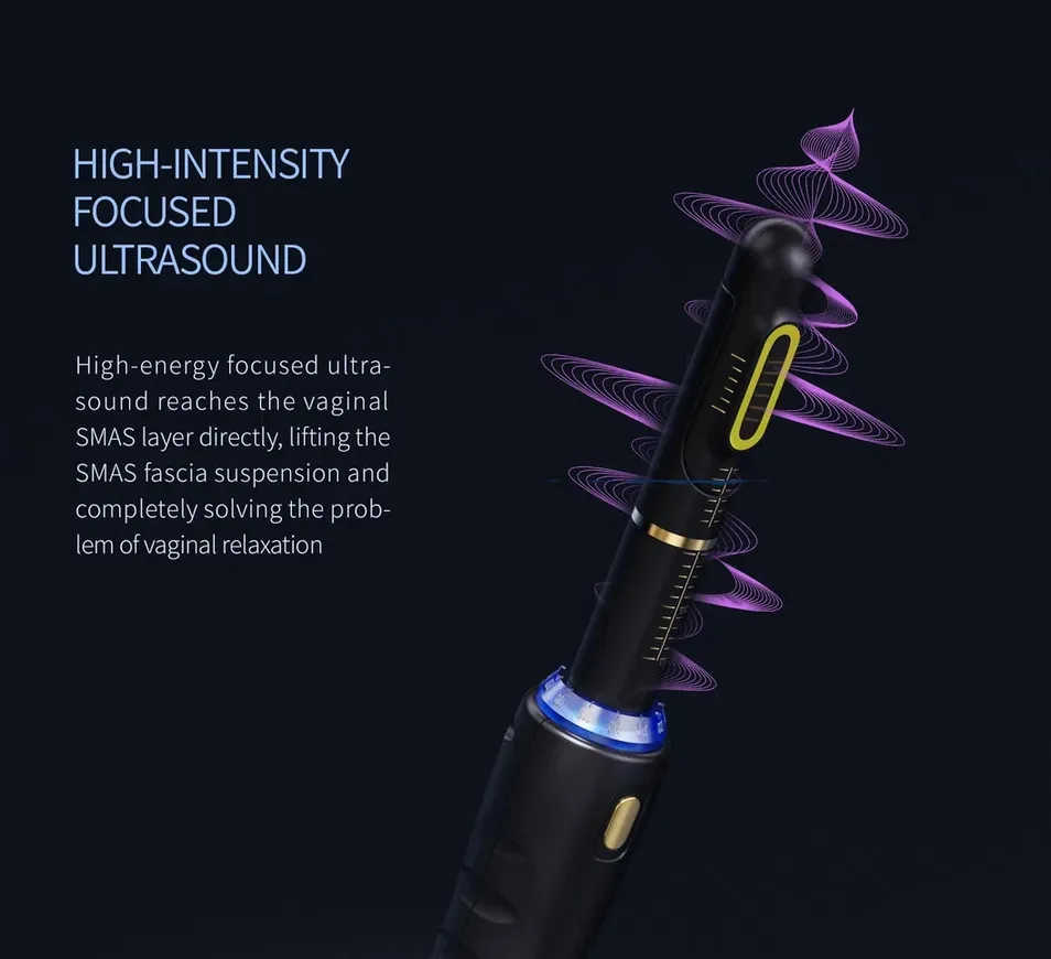 Operating handle design
