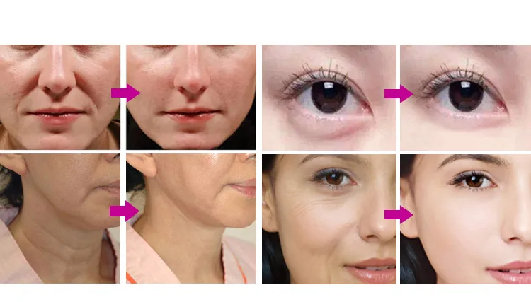 Before & After Results