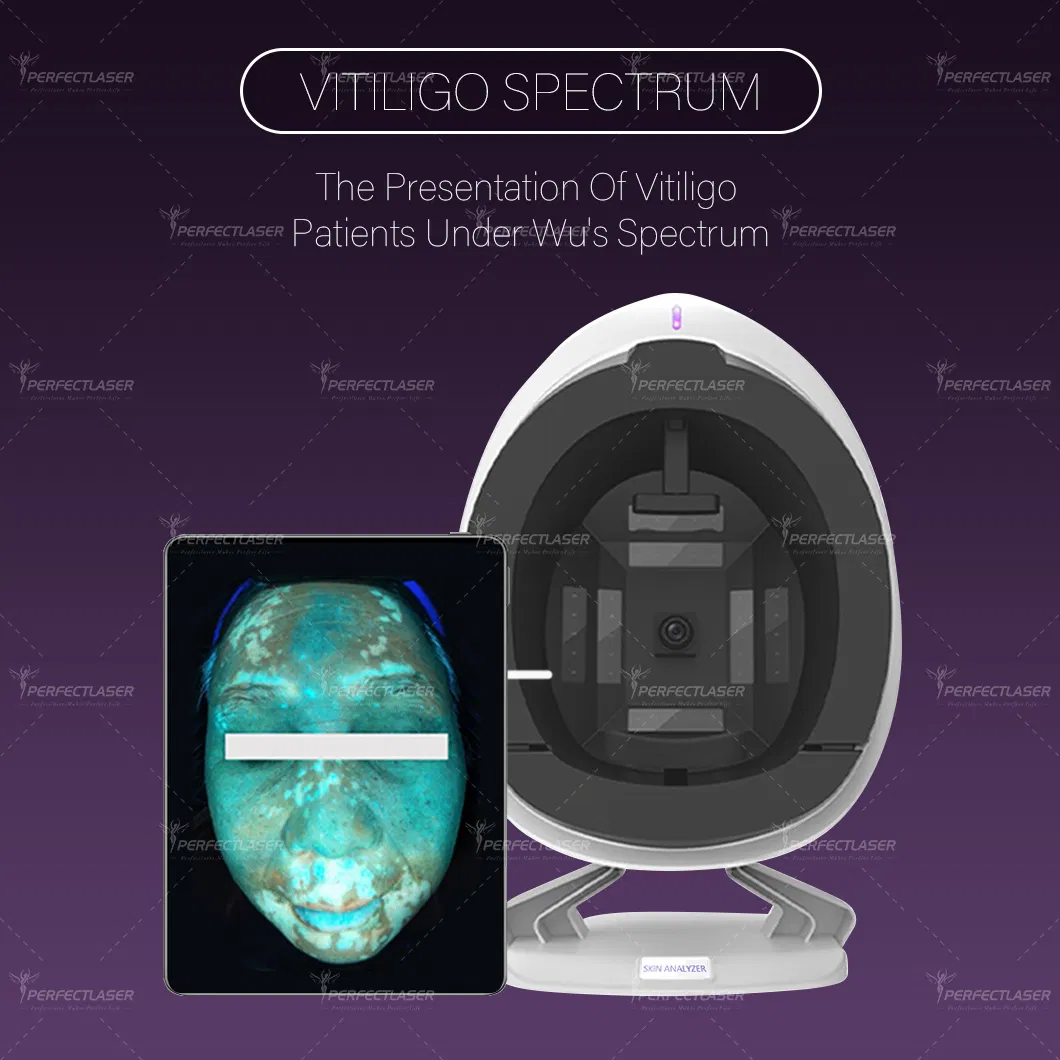 Best Ai Smart 15.6 Inch Screen Skin Analysis Machine