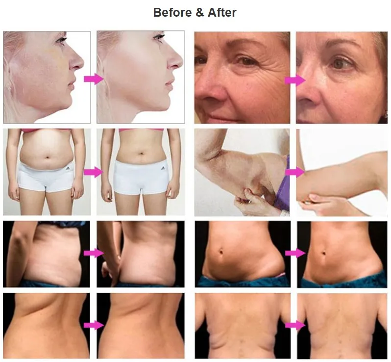 Advanced Treatment Progress