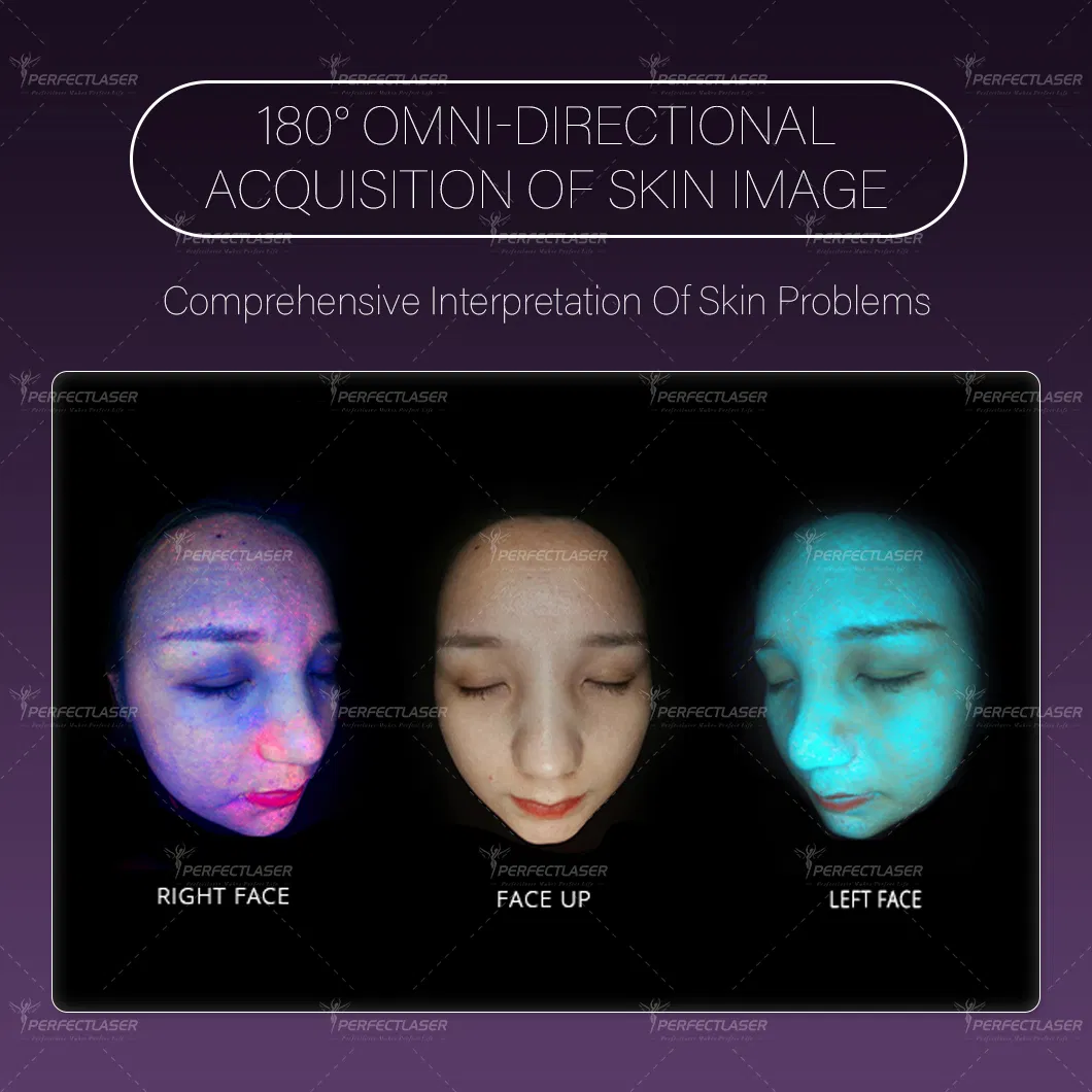 Best Ai Smart 15.6 Inch Screen Skin Analysis Machine