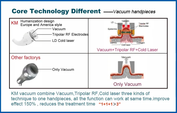 Vacuum Handpiece detailed look