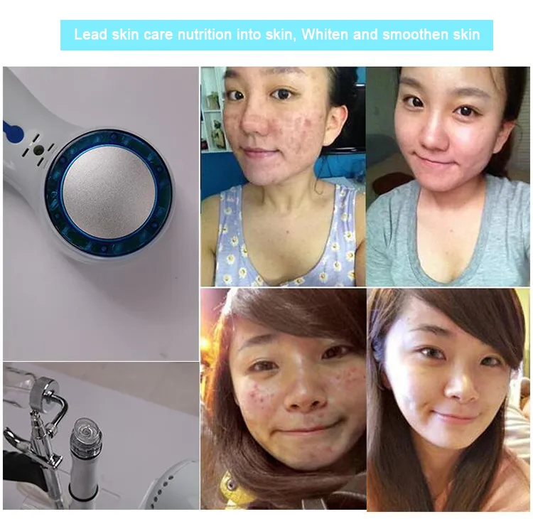 5 in 1 Ultrasound + Cooling Cleansing Small Bubble Oxygen Facial Machine