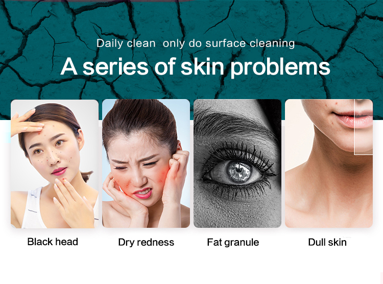 Hydrodermabrasion Face Cleaning Machine View 1