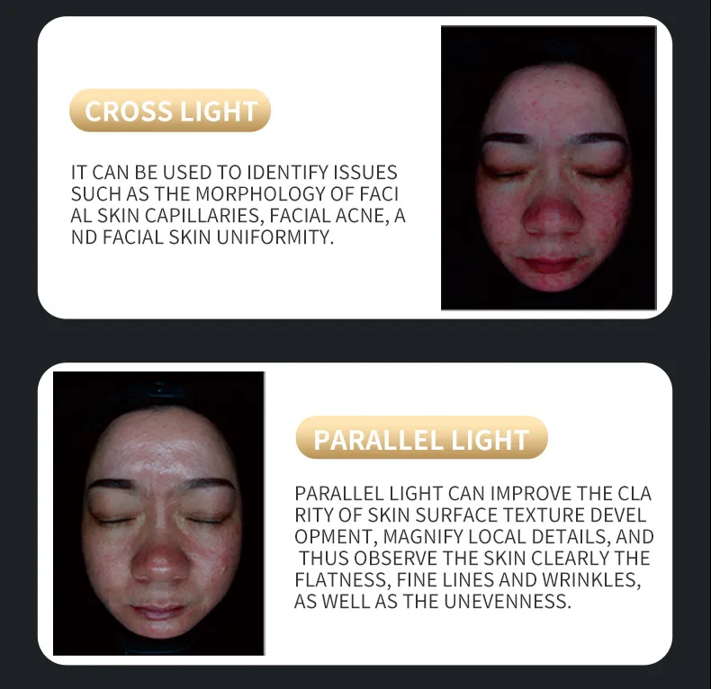 X5 Ultra Clear Skin Analyzer Ai Face Scanner 3D Facial Analysis Machine