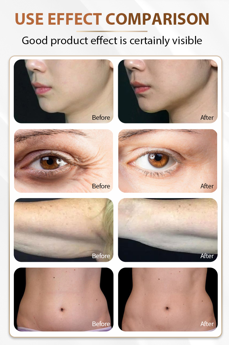 Professional Dual Frequency Ultrasonic Cavitation RF Skin Rejuvenation Anti Wrinkle Beauty Machine for SPA Clinic Use