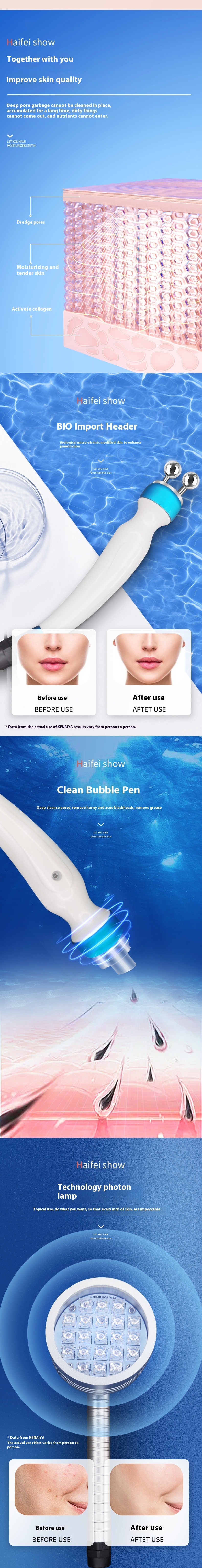 14-in-1 Oxigen Facial Machine Multifunctional Beauty Equipment Large Small Bubble Hydrogen Jet Peel Facial Machine