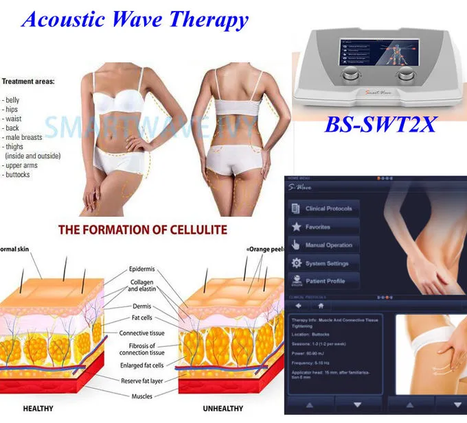 SmartWave clinical application case study