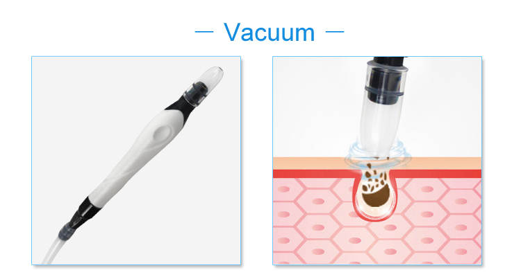 Vacuum Suction Probe