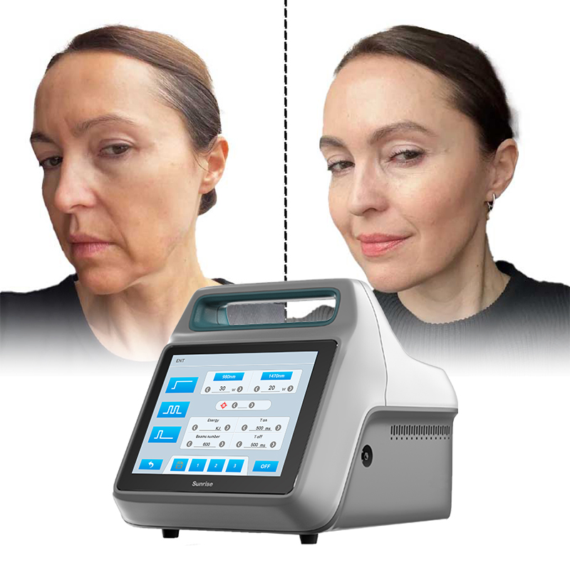 Portable 30+20W 980 1470 Diode Laser Belly Fat Removal Facial Lifting Endo Lifting Lipolysis Liposuction Endolaser Machine