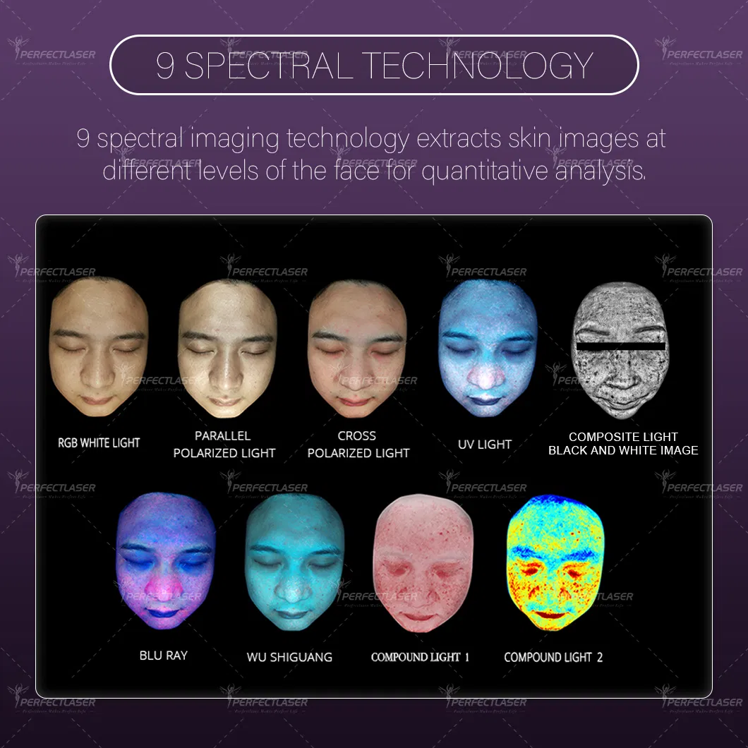 Best Ai Smart 15.6 Inch Screen Skin Analysis Machine
