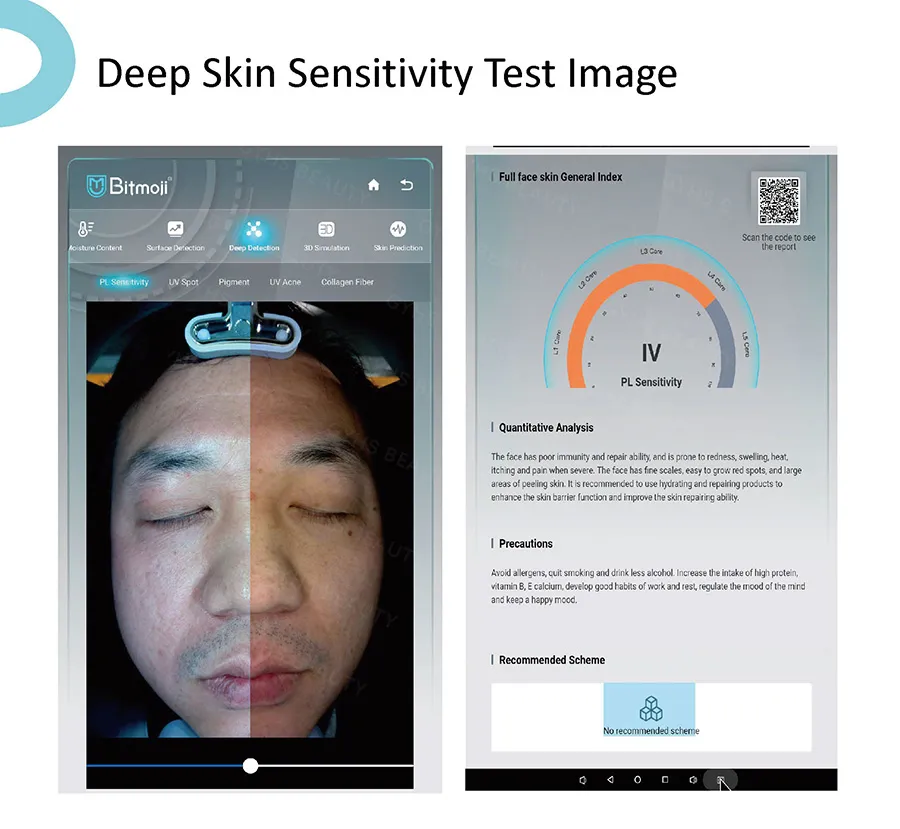Ai Skin Scanner Machine for Skin Diagnosis Deep Facial Analysis Equipment 8