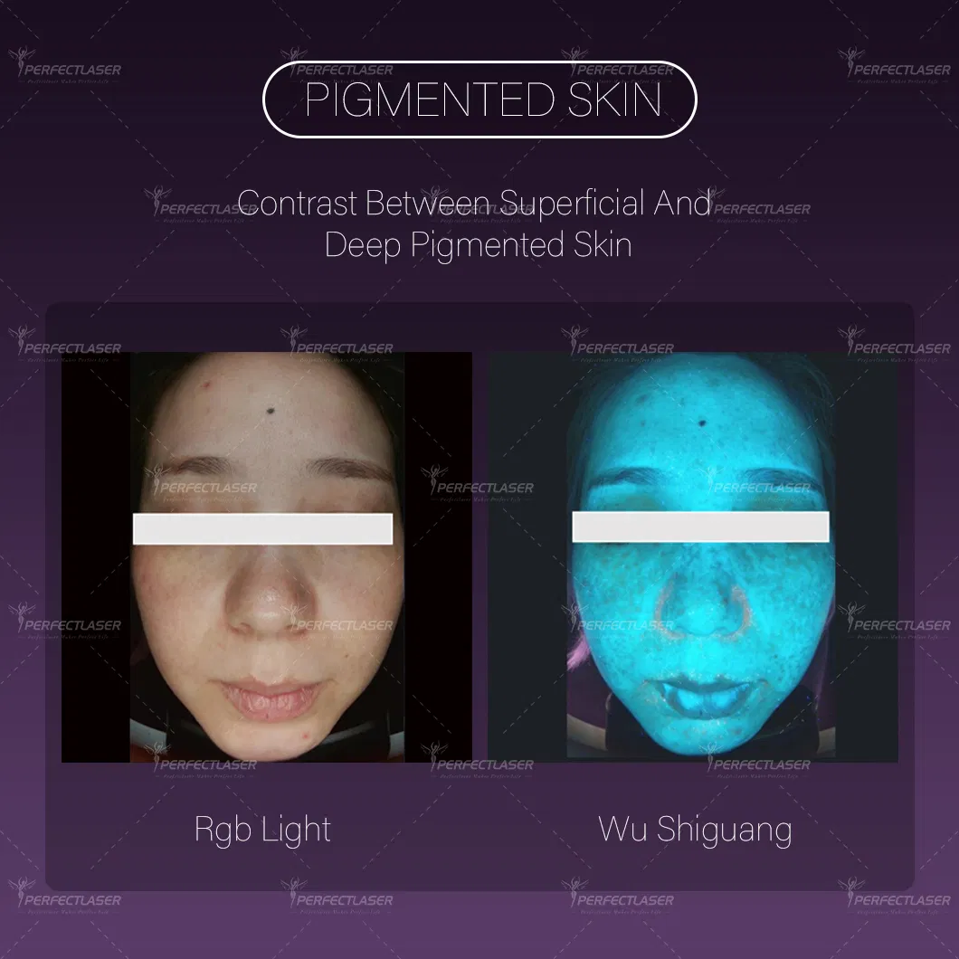 Best Ai Smart 15.6 Inch Screen Skin Analysis Machine