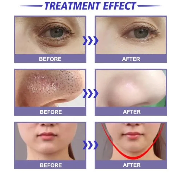 Before and After Treatment Results