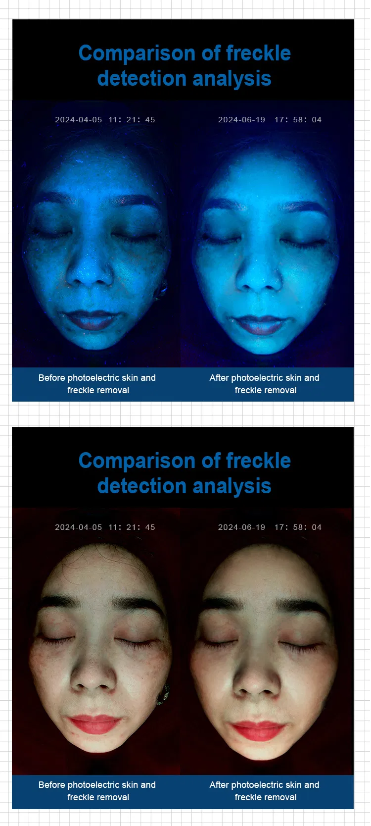 Before and After Comparison