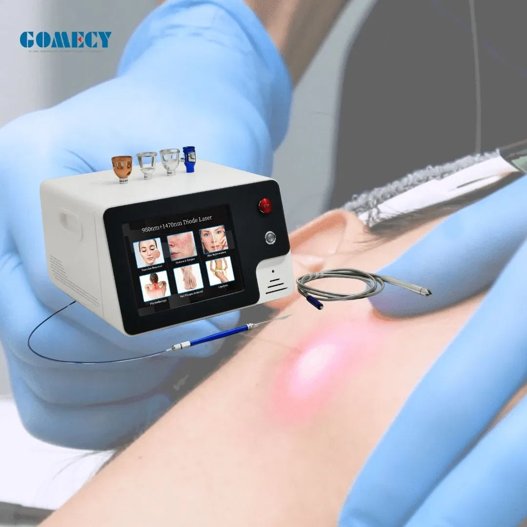 980 Nm 1470nm Portable Endolaser Endolaser Diode Para Lifting Facial Face Lifting Fat Lipolysis Machine 980nm