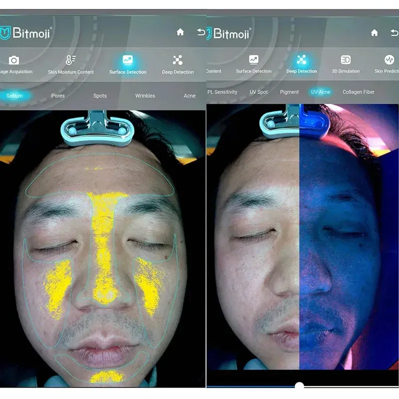 Skin Analysis Process 4